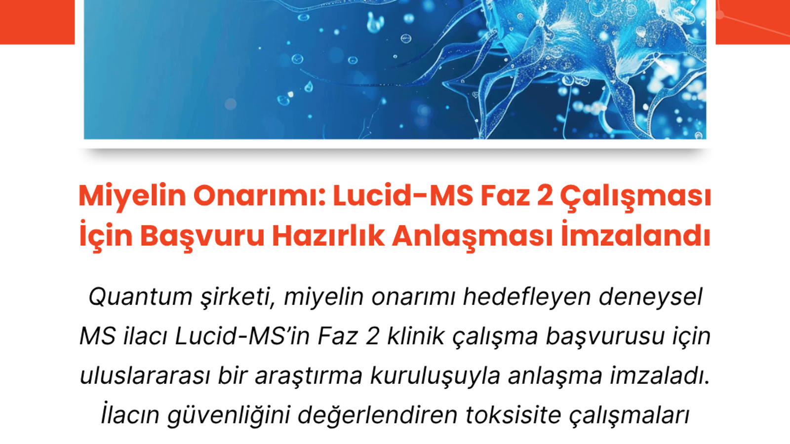 Miyelin Onarımı: Lucid-MS Faz 2 Çalışması - Hazırlık Anlaşması İmzalandı