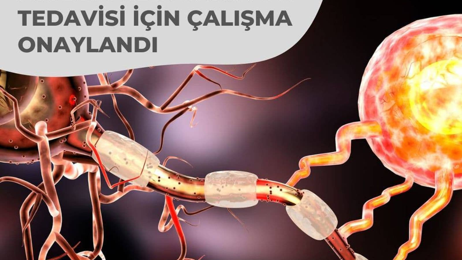 PİPE-307, Potansiyel RRMS Miyelin Restorasyon Tedavisi İçin Çalışma Onaylandı